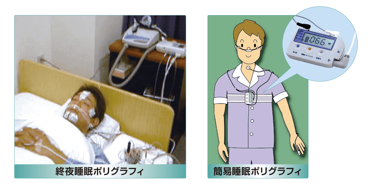 終夜睡眠ポリグラフィ・簡易睡眠ポリグラフィ