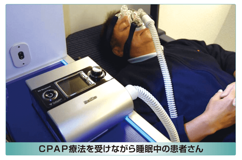 CPAP療法