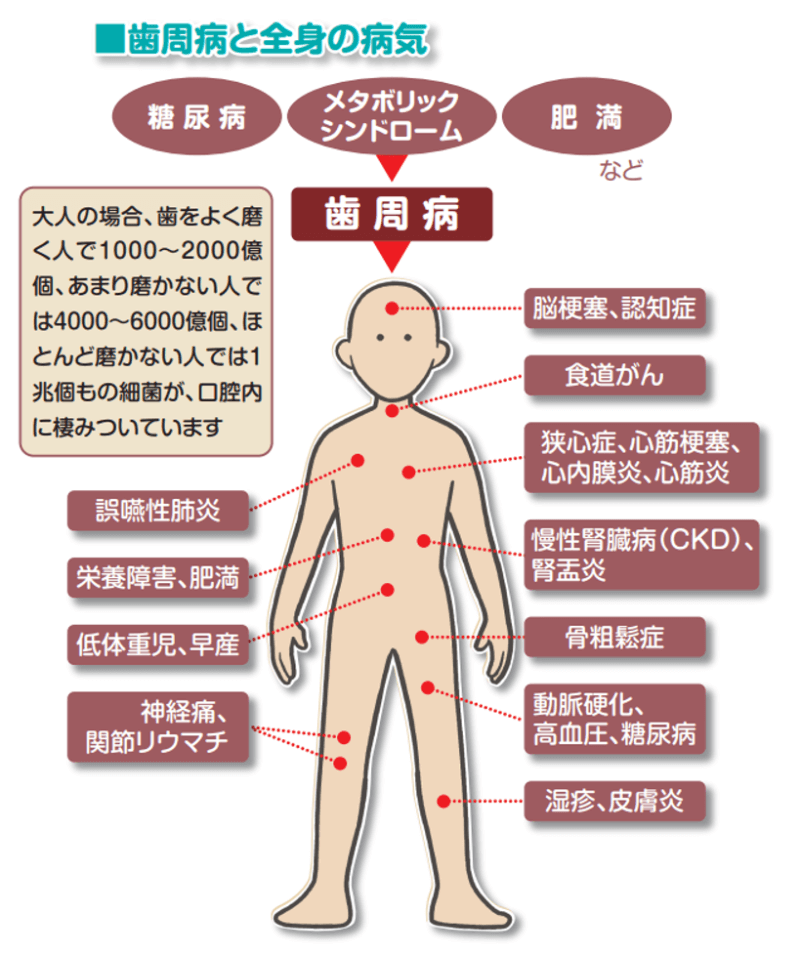 歯周病と全身の病気