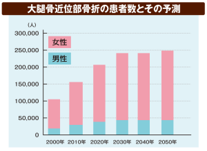 大腿骨近位部骨折の患者数とその予測