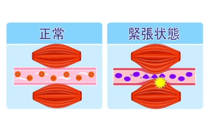 肩こりのメカニズム